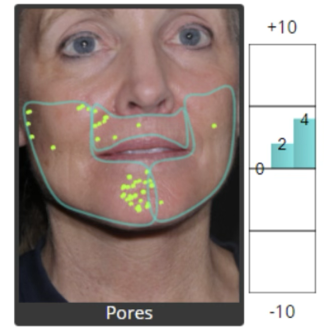 Pore visibility analysis before restoration