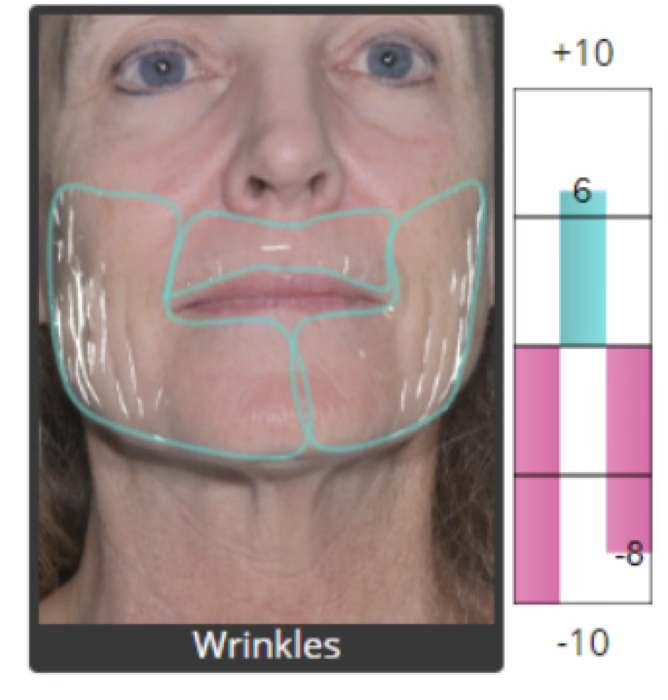 Wrinkle analysis before restoration
